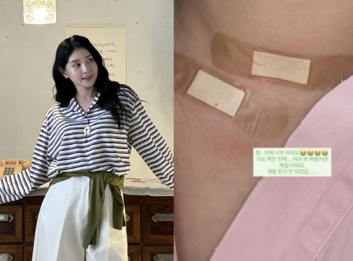 '6기 영철♥' 영숙, 갑상선암 수술 앞두고 불안 "전이 확인 중, 잠도 안 와"