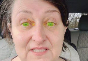 안과 진료 중 '형광 녹색 눈'으로 변해, 이유 알고 보니…