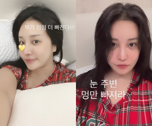 랄랄 맞나...눈밑·코 성형→3kg 감량 후 확 달라진 분위기 