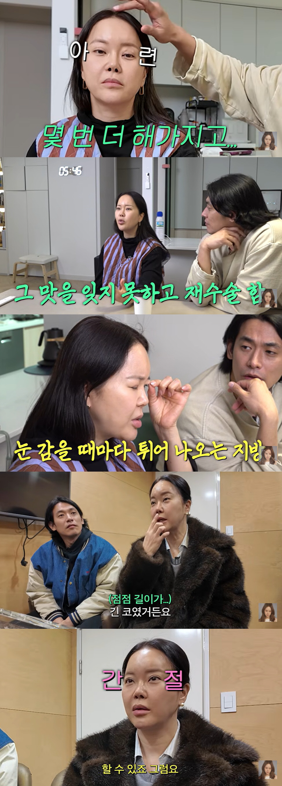 백지영, 짧아진 코에 재수술 고민 "다시 돌아가면 성형 안 해"