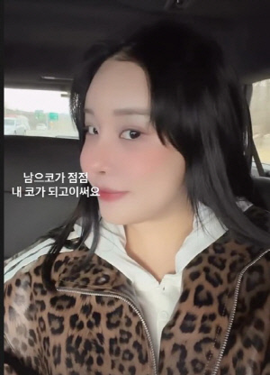 랄랄, 코 성형 다이어트로 '인생 역전' 비주얼…몰라보게 예뻐졌네