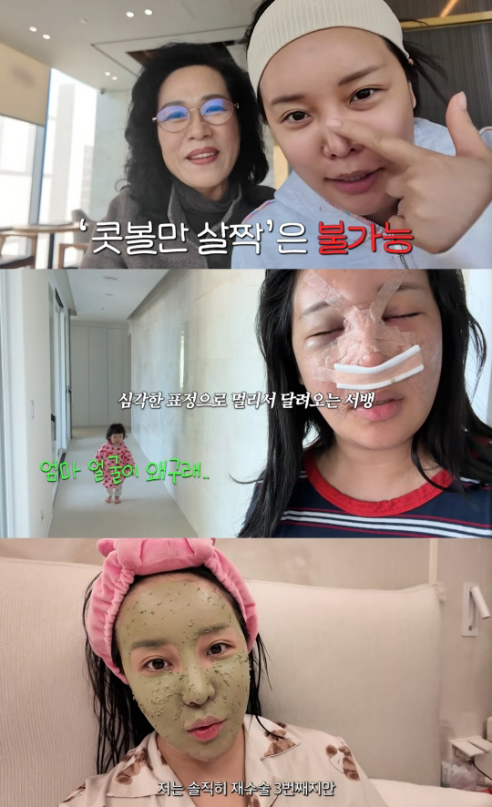 랄랄, 코 성형수술만 3번째 "이런 적은 처음...주변서도 놀라"