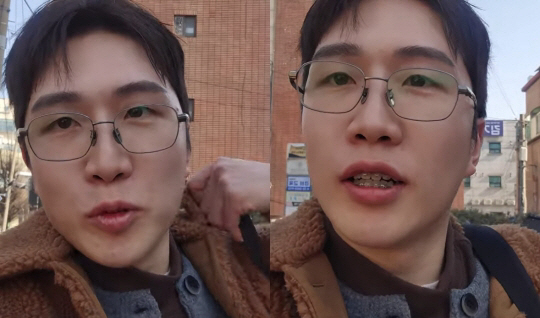 24기 영식, 확 달라진 얼굴...또렷해진 눈매에 치아교정까지 '성형 의…