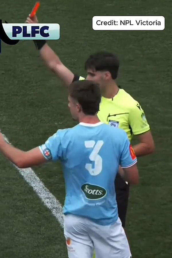 "태블릿에 이마 박고 피 철철" 日 신성, 호주 2부서 17살짜리에게 몹…