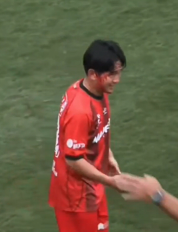 "태블릿에 이마 박고 피 철철" 日 신성, 호주 2부서 17살짜리에게 몹…