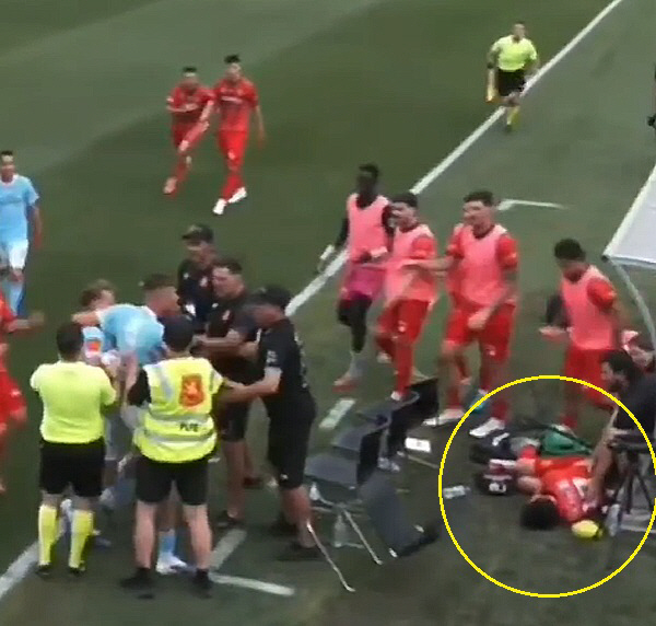 "태블릿에 이마 박고 피 철철" 日 신성, 호주 2부서 17살짜리에게 몹…