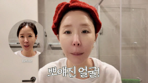 '5월 결혼' 신지, 얼굴 완전히 달라졌다..'비포 애프터 영상' 공개 