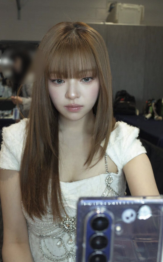 트와이스 정연, 독하게 살 빼고 확 달라진 얼굴...스테로이드 부작용 극…