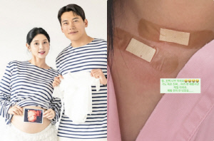 '갑상선암 고백' 6기 영숙, 전조증상 밝혔다 