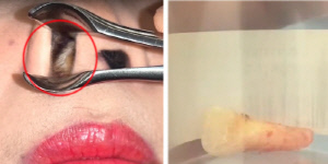 코 안에 왜 치아가 있지? …