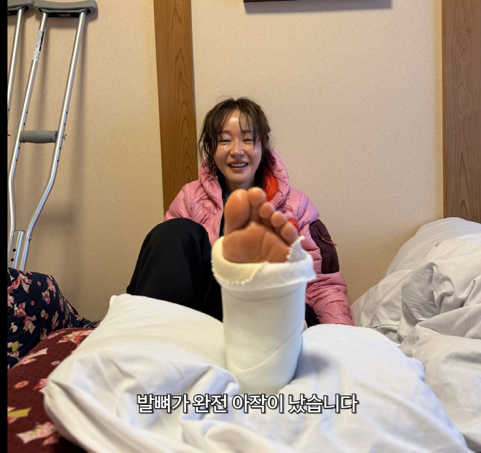 "발목 뼈가 완전 산산조각 나"…엄지원, 日여행중 돌발 사고→韓긴급후송 …