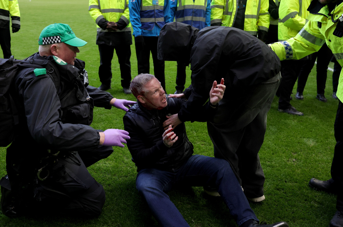 "이게 축구야! 충격 또 충격" 올드펌 더비, '피 철철' 폭력 사태…'…