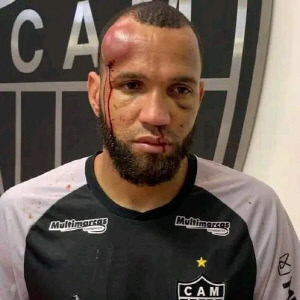 얼마나 폭행 당했으면 얼굴이 이래! 충격 실화...'23명 퇴장' 축구 역사상 최다 퇴장 '역대급 패싸움'→'안면 박살' 대량 출혈 발생