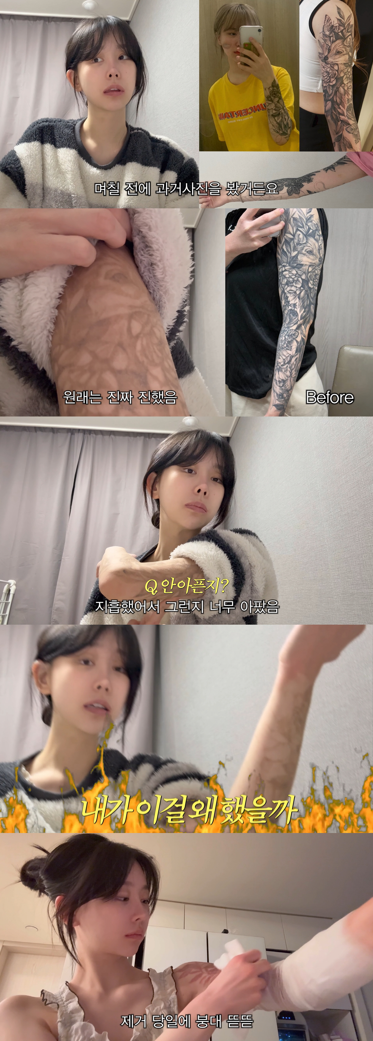 '애둘맘' 조두팔, 2800만원 들여 '팔 뒤덮은 문신' 제거 "죽을만큼…