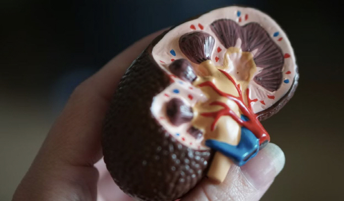 "과일·단백질 과도한 섭취 NO"…무심코 콩팥 건강 해치는 습관들