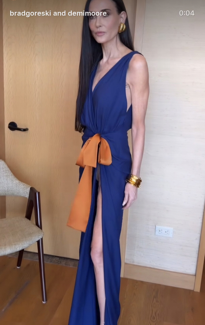 ‘7억 전신 성형’ 톱스타, 63세인데 또 고쳤나..점점 젊어지는 외모