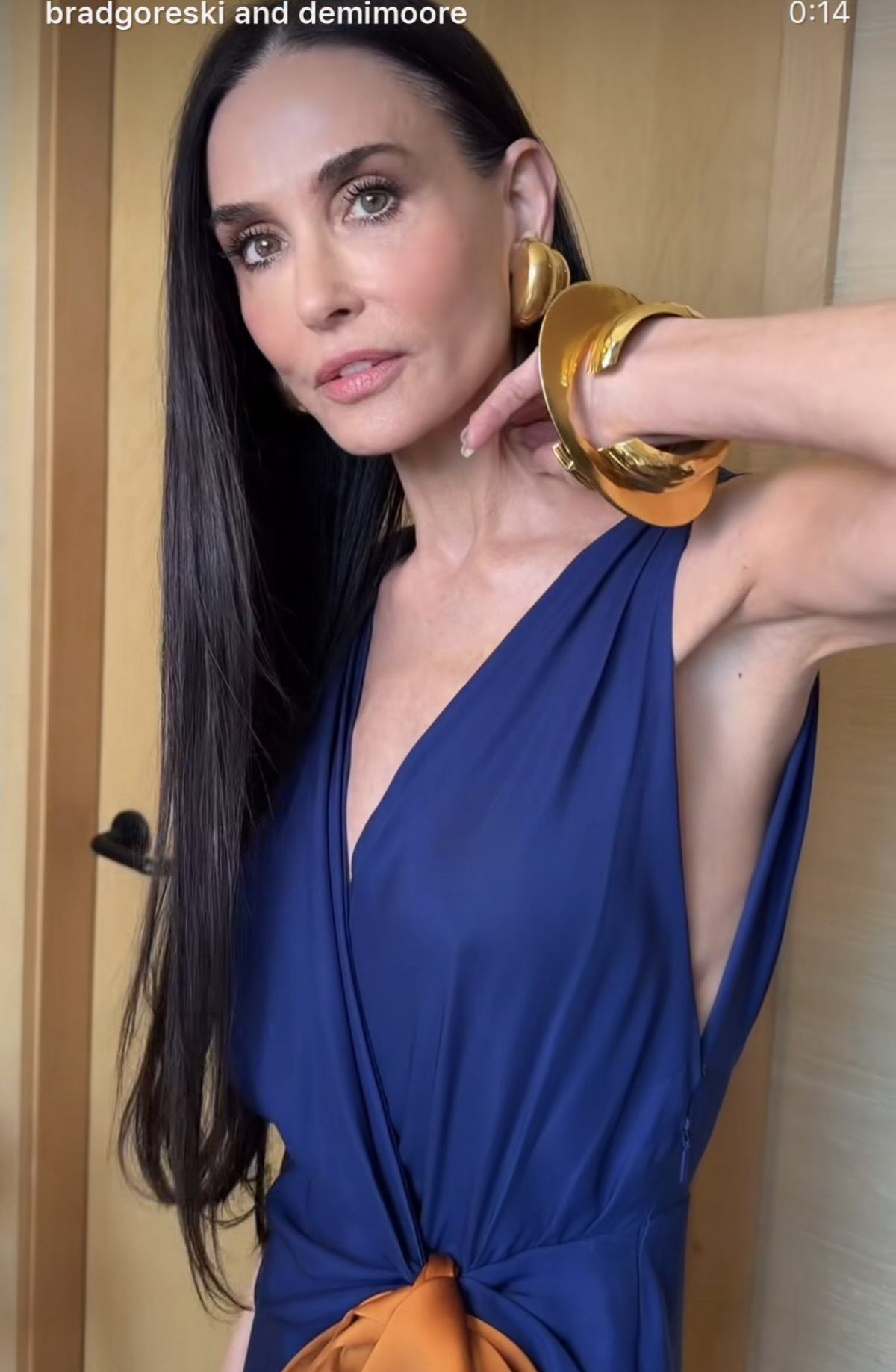 ‘7억 전신 성형’ 톱스타, 63세인데 또 고쳤나..점점 젊어지는 외모