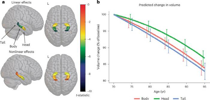 "걷기 좋은 도시 환경, 치매 위험 낮아"…이유가 있었다