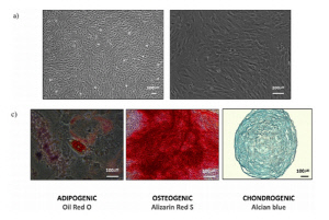 외상성 뇌손상 치료 새 가능성 열었다…수술 없이 '코'로 줄기세포 전달