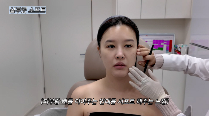 '43세' 박은지, 실리프팅 후 볼 패였다 