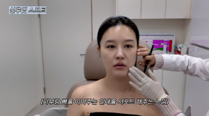 '43세' 박은지, 실리프팅 후 볼 패였다 