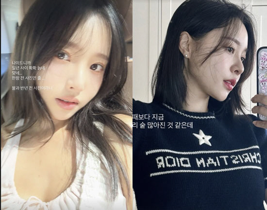 "1년, 3년 살 수 있을지 몰랐다" 박성광♥ 이솔이, 항암으로 빠진 머…