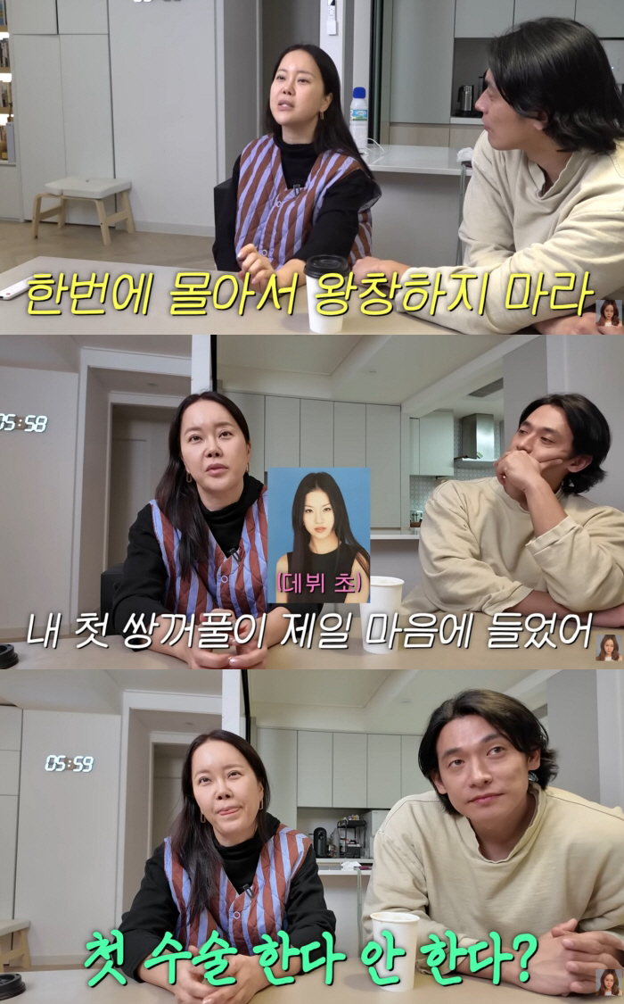 백지영, 눈·코 성형 후회 "첫 쌍꺼풀은 만족...얼굴에 10억 들이진 …