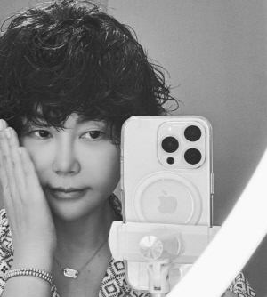 황혜영, 리프팅 시술로 퉁퉁 부은 얼굴 