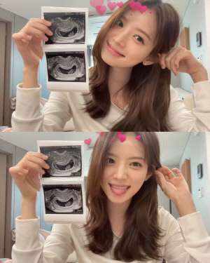 '하시4' 김지영, 2세 성별 공개→'훈남 CEO' ♥남편 미소 포착 