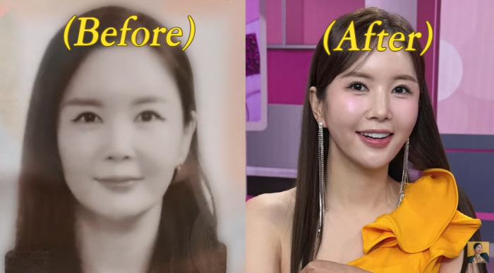 장영란, '성형 4번' 전 여권 사진 공개…