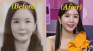 장영란, '성형 4번' 전 여권 사진 공개…