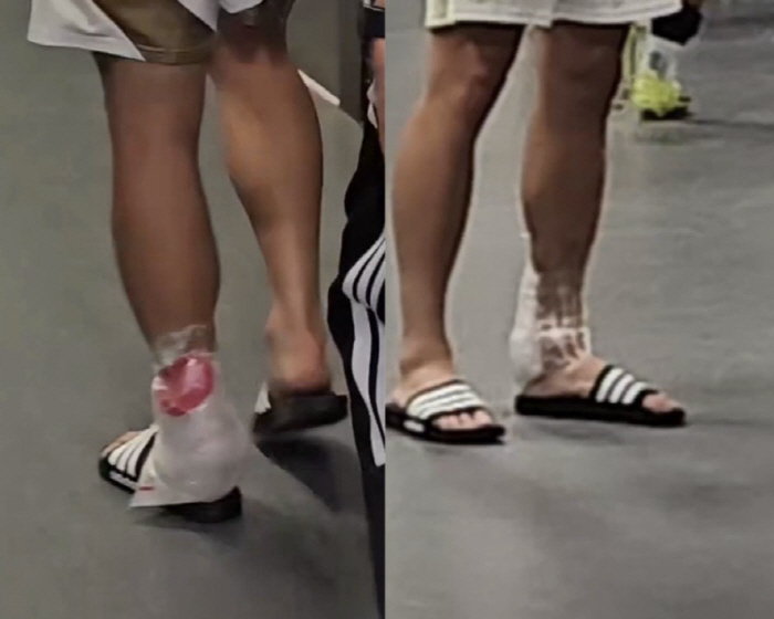 韓 축구 철렁! '피 철철' 발목 부상 위기, 손흥민 월드컵 못 나가야 …