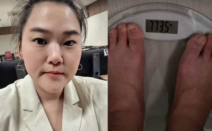'148kg→77kg' 미나 시누이, 완전히 다른 사람 됐다..요요 딛고 재감