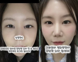 '미스터 킴♥' 28기 순자, 앞트임까지 했다..7일만 '확 달라졌다'