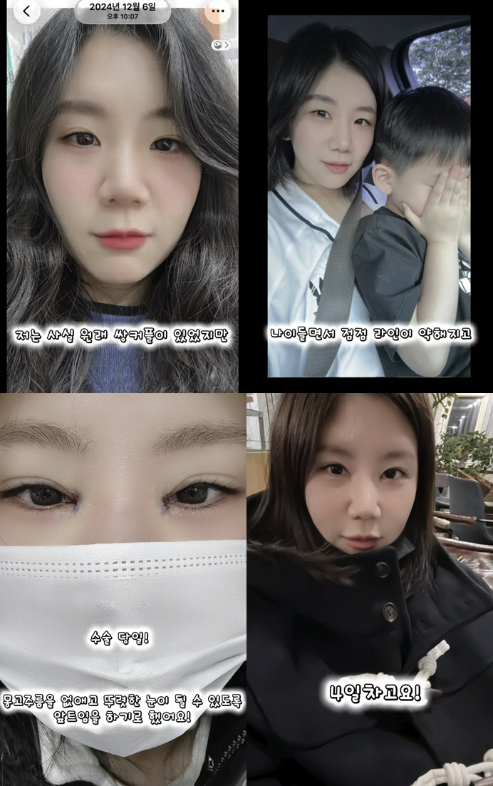 '미스터 킴♥' 28기 순자, 앞트임까지 했다..7일만 '확 달라졌다'