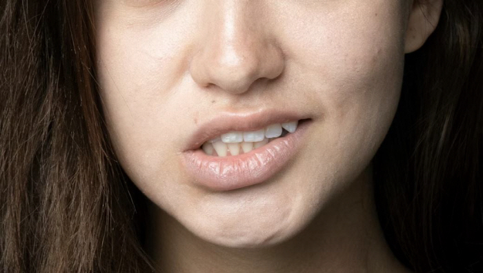 피곤해서 눈 떨리는 줄, 얼굴 전체로 퍼졌다면…