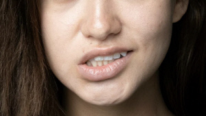 피곤해서 눈 떨리는 줄, 얼굴 전체로 퍼졌다면…