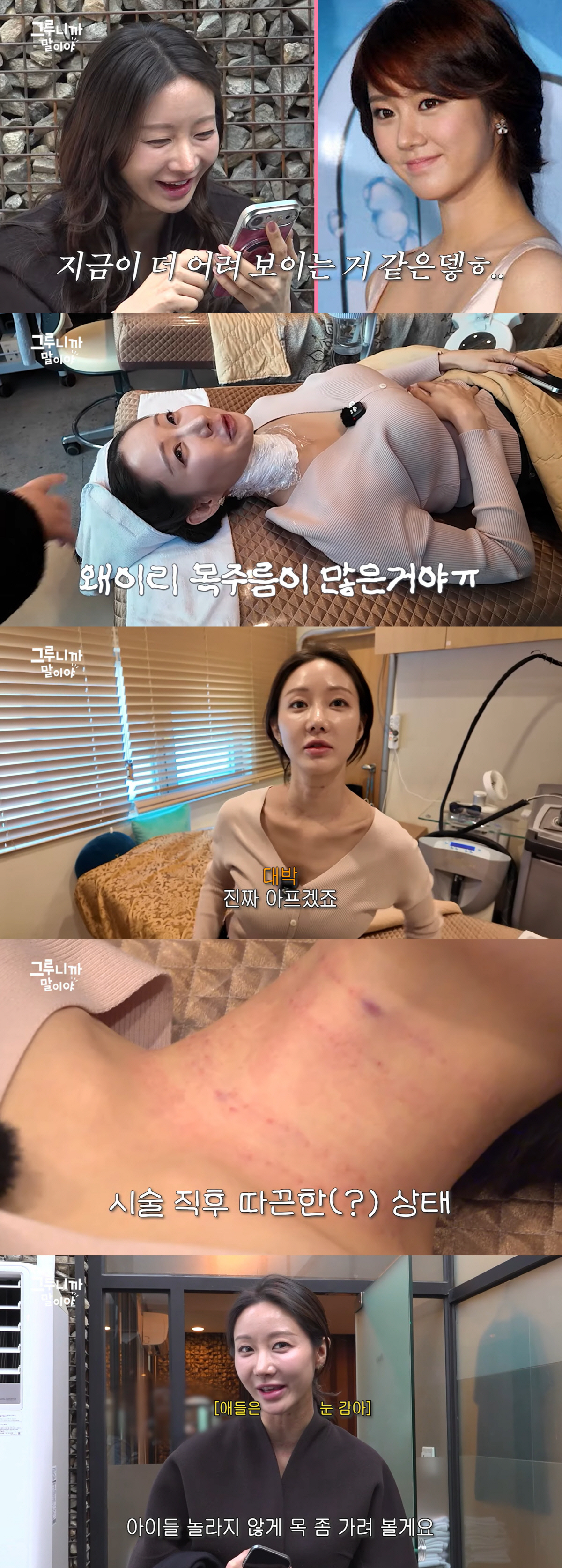 '싱글맘' 한그루, '목주름 시술' 후 확 달라졌다 "효과 너무 좋아"