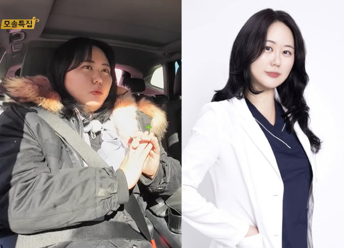'모솔 의사' 19기 현숙, 방송 후 15kg 감량 "약·시술·운동 다 했다"