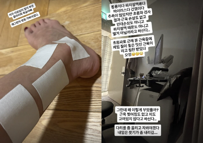 '윤종신♥' 전미라, 통풍 의심할 만큼 심한 부종…검사 결과는 뜻밖의 '…