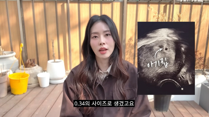 '난임' 서동주, 포기 직전 아기집 '0.34→0.67' 커졌지만...