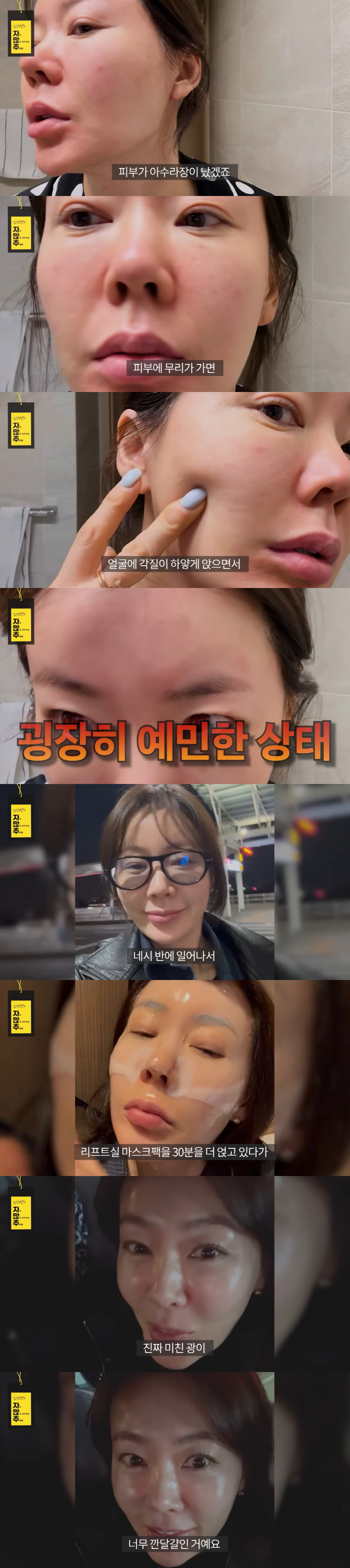 안선영, '아수라장' 피부 상태 충격 "풀메 후 노세안, 다 뒤집어져" …