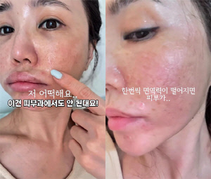 '원조 베이글녀' 강예빈, 보정 없는 민낯 상태가 '충격'…