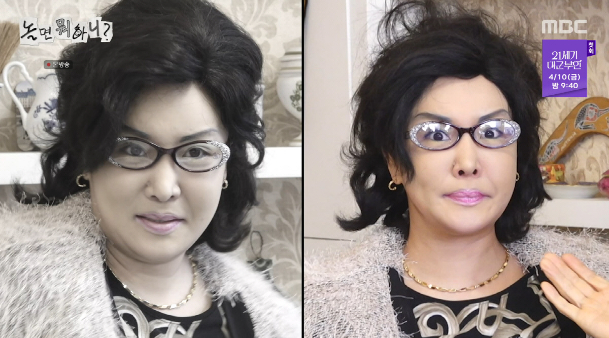 랄랄, 코 성형 후 대만족 "늑골 코에다 붙여"...유재석도 "잘 됐다"…