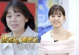 '영호 잡도리' 30기 영숙, '얼굴 치아' 시술 후 확 달라졌다 