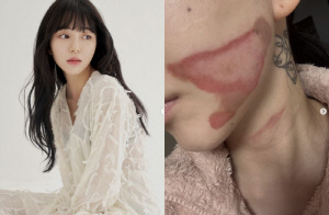 권민아, '얼굴 화상 사고' 후 새 일자리 찾았다 