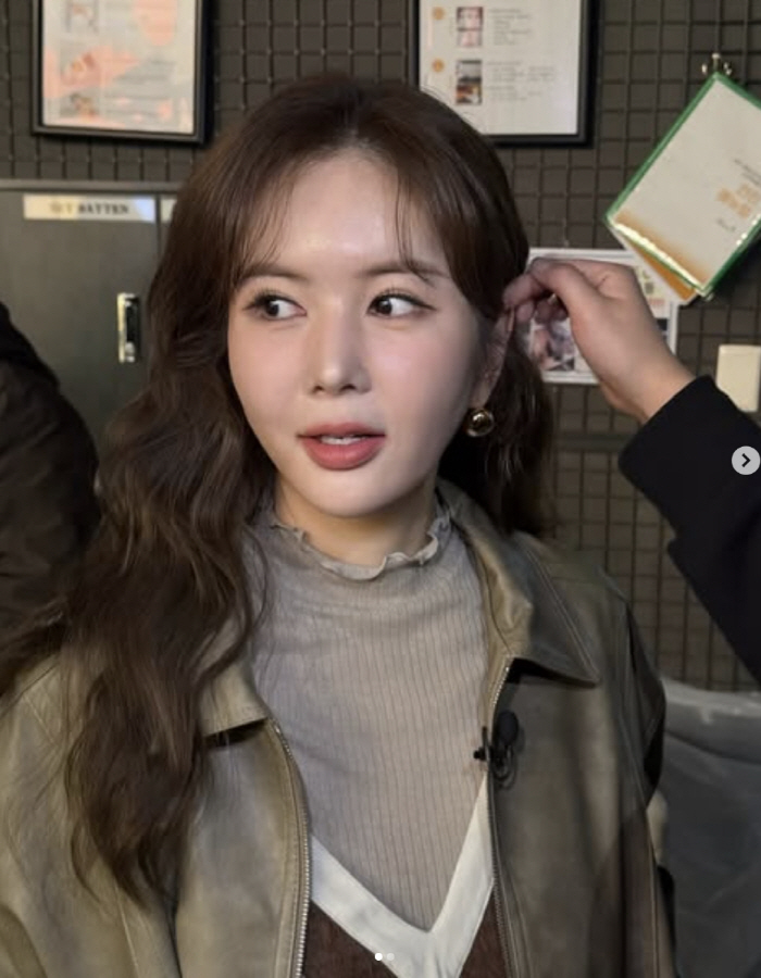 장영란, 입술 필러 논란에 억울한 해명 "맞았으면 맞았다 얘기한다"