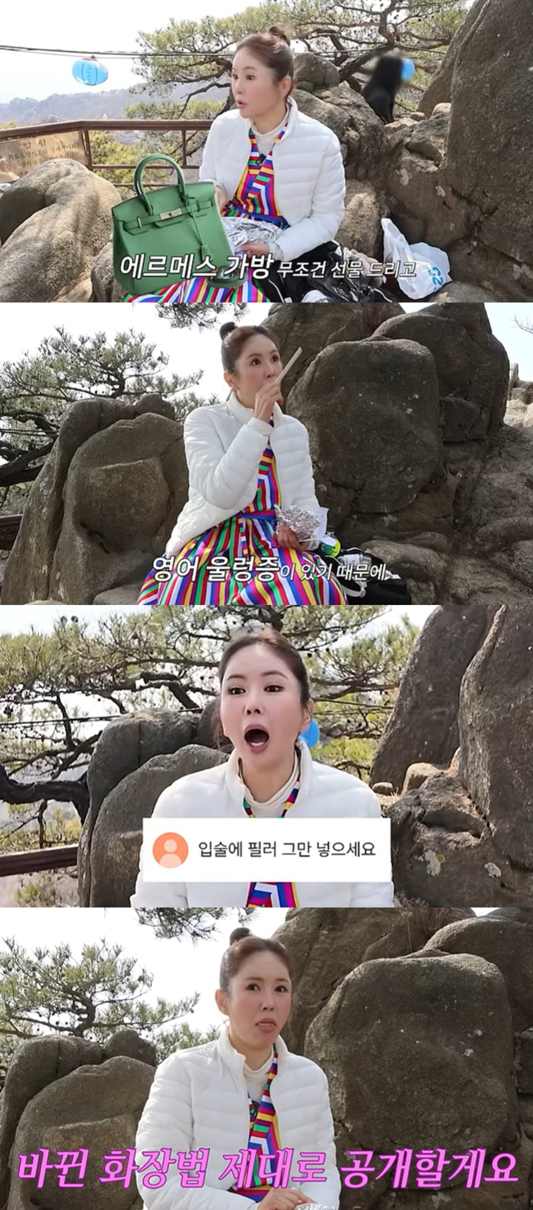 장영란, 입술 필러 논란에 억울한 해명 "맞았으면 맞았다 얘기한다"