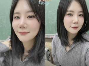 '미스터 킴♥' 28기 순자, 쌍꺼풀·앞트임 후 확 달라졌다..또렷해진 미모 '깜짝'