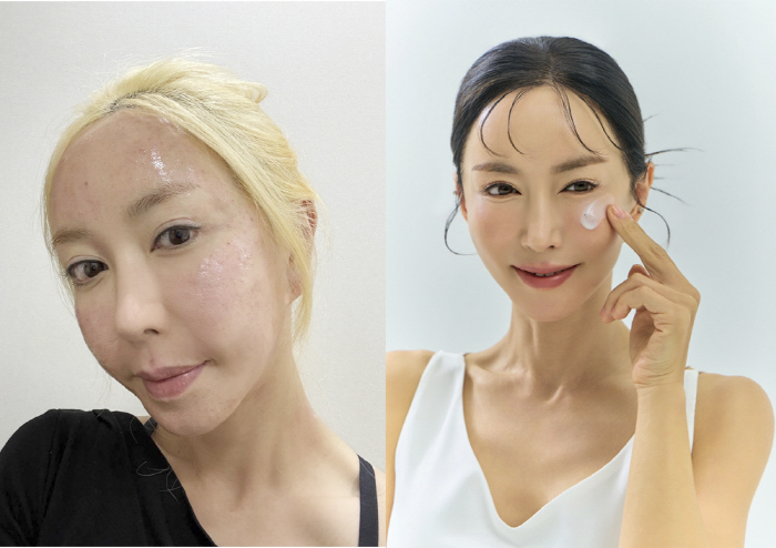 슈, 같은 사람 맞나...'얼굴 시술' 효과에 깜짝